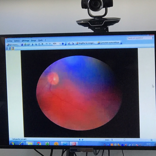 Santé : Un séminaire sur la téléconsultation en Haute-Corse