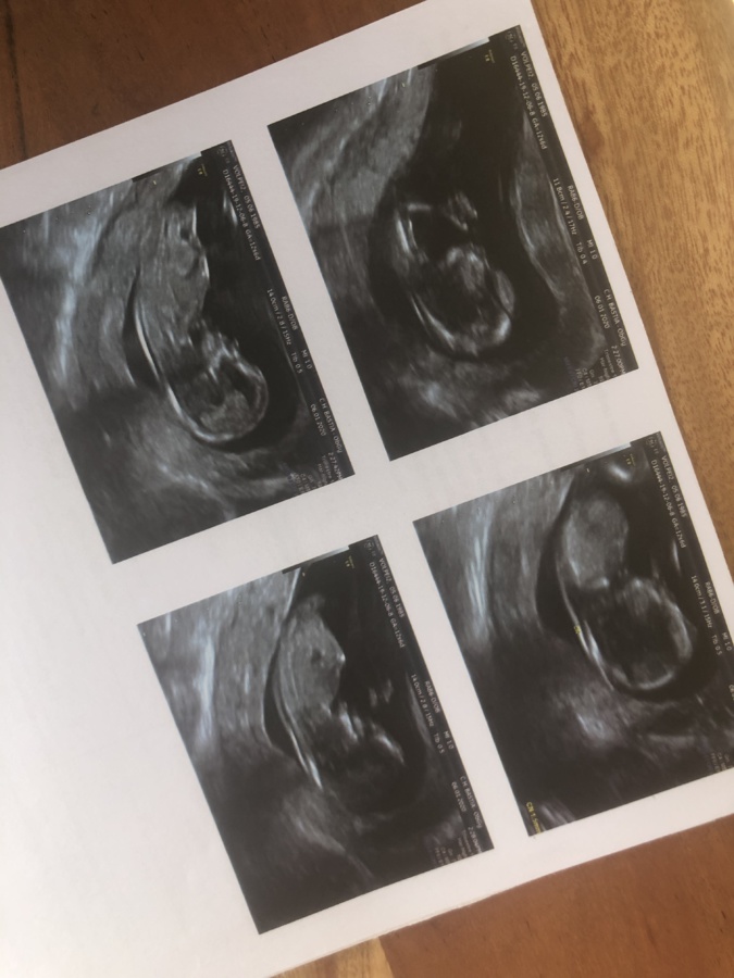 Journal du confinement, jour 19 : enceintes et confinées, drôle de situation Journal du confinement, jour 19 : enceintes et confinées, drôle de situation