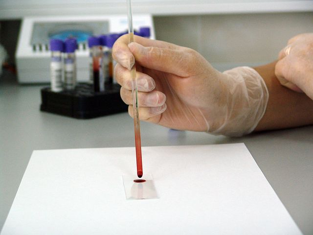 Covid-19 : les pharmacies désormais autorisées à réaliser des tests sérologiques