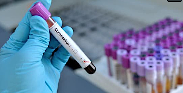 Coronavirus : toujours aucun cas positif en Corse ce 21 juillet