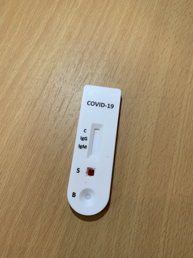 Des tests sérologiques disponibles à la pharmacie de Calenzana Des tests sérologiques disponibles à la pharmacie de Calenzana