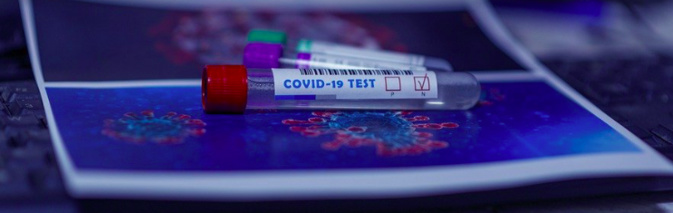 Covid-19 en Corse : 65 nouveaux cas et légère hausse de patients en réanimation Covid-19 en Corse : 65 nouveaux cas et légère hausse de patients en réanimation