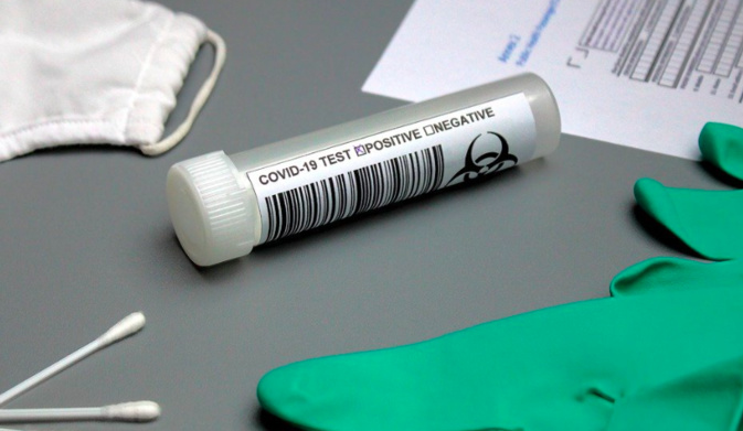 Covid-19 : 6 cas positifs et 41 personnes hospitalisées ce 27 mai en Corse