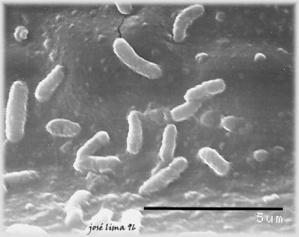 Prévention de l’introduction en Corse de la Xylella Fastidiosa Prévention de l’introduction en Corse de la Xylella Fastidiosa