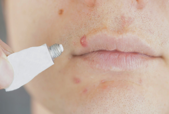 Les effets bénéfiques de l’argent colloïdal Les effets bénéfiques de l’argent colloïdal