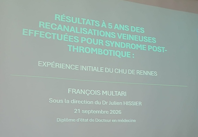 Bastia - François Multari soutient sa thèse de médecine au CHU de Rennes