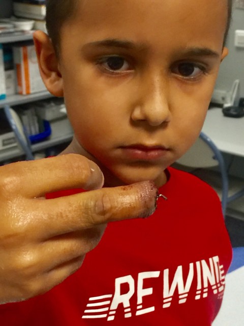 Nouvelle opération et greffe de peau pour Enzo