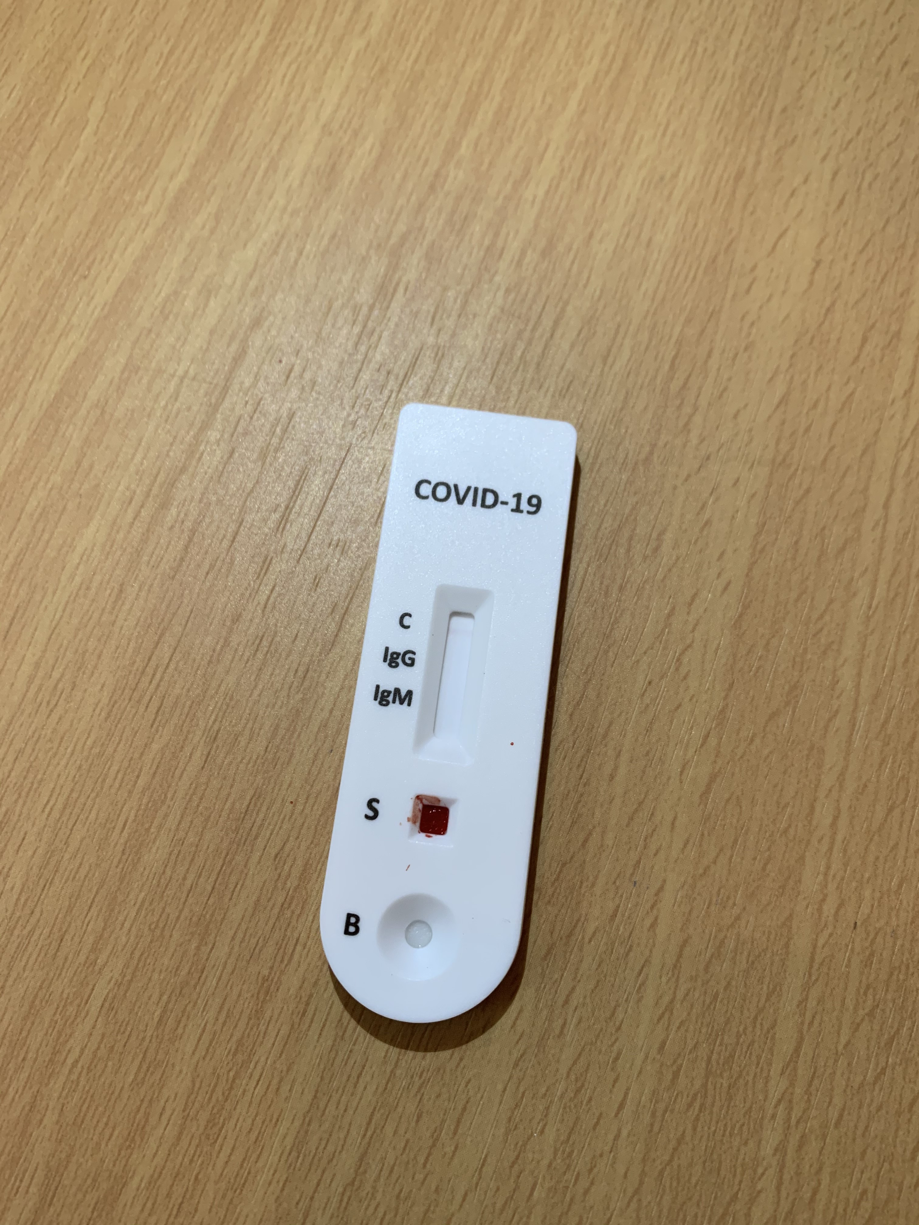 Des tests sérologiques disponibles à la pharmacie de Calenzana