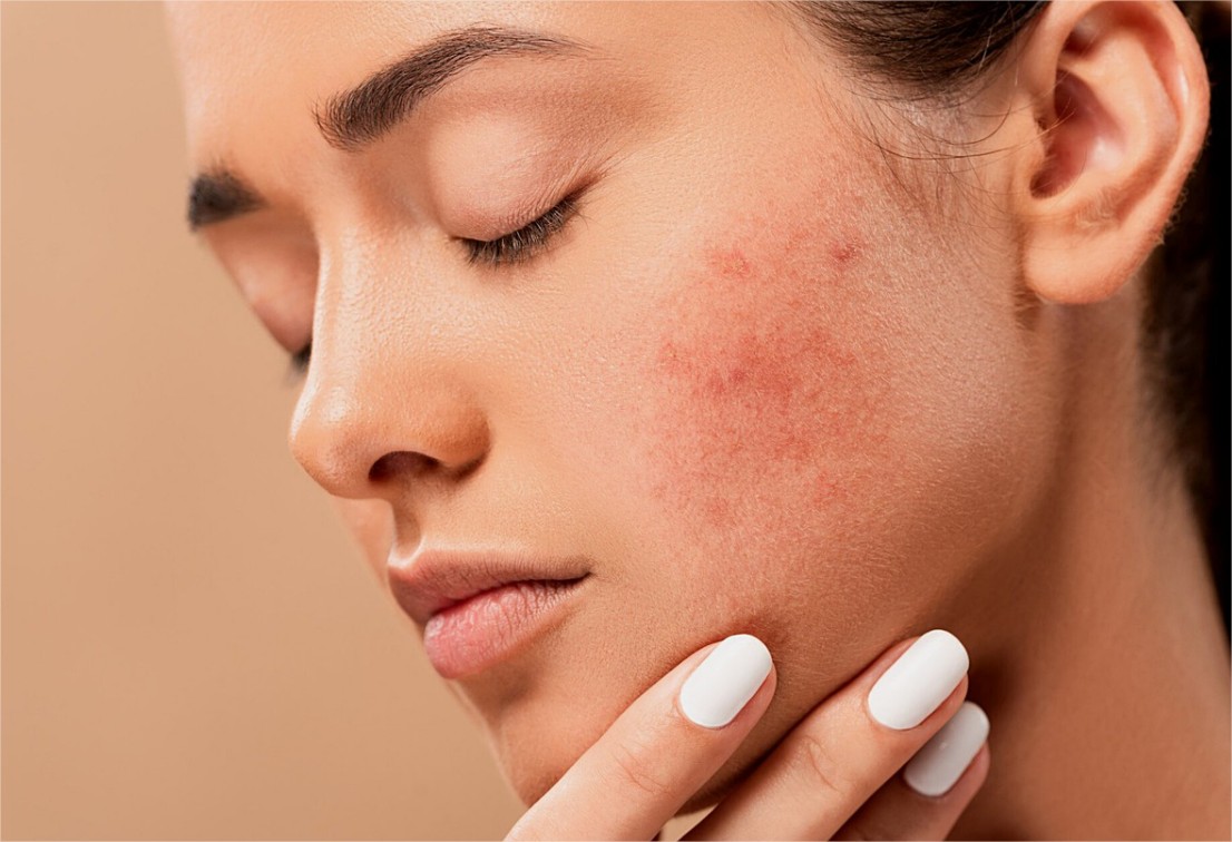 Coronavirus : une augmentation des consultations chez les dermatologues