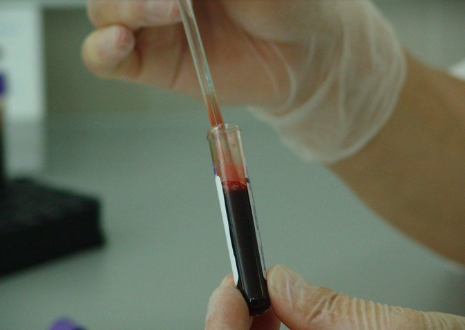 Le dépistage est primordial pour bien traiter la maladie. Image d'illustration