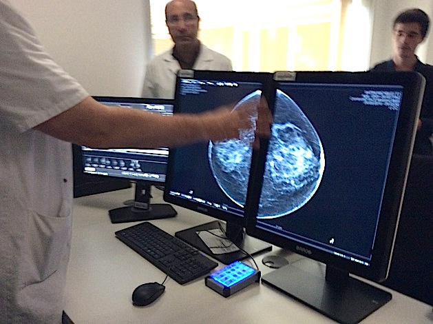 Cancer du sein : L’hôpital de Bastia investit dans des équipements à la pointe de la technologie