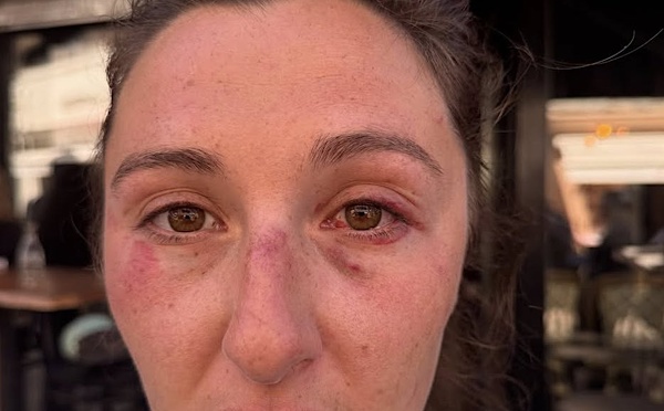 Agression sur un ferry : une passagère blessée, un rassemblement de soutien prévu à Porto-Vecchio