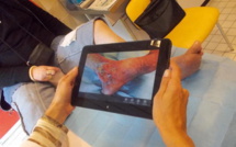 Plaies chroniques et complexes : le premier dispositif corse reconnu au titre de l’article 51