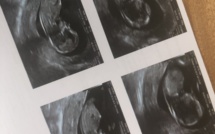 Journal du confinement, jour 19 : enceintes et confinées, drôle de situation