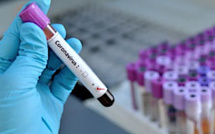 Covid-19 en Corse : 14 tests positifs supplémentaires