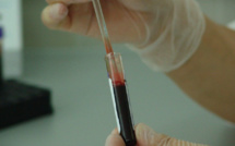  Les tests de dépistage du Sida en chute libre en Corse : "2021 sera catastrophique"