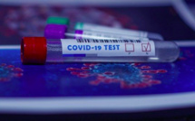 Covid-19 en Corse : 65 nouveaux cas et légère hausse de patients en réanimation