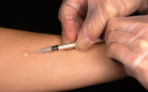 Variole du singe : 3 cas confirmés en Corse et 21 personnes vaccinées