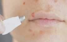 Les effets bénéfiques de l’argent colloïdal