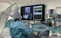 A l'hôpital de Bastia, une nouvelle technique d'opération pour soigner l'arythmie cardiaque
